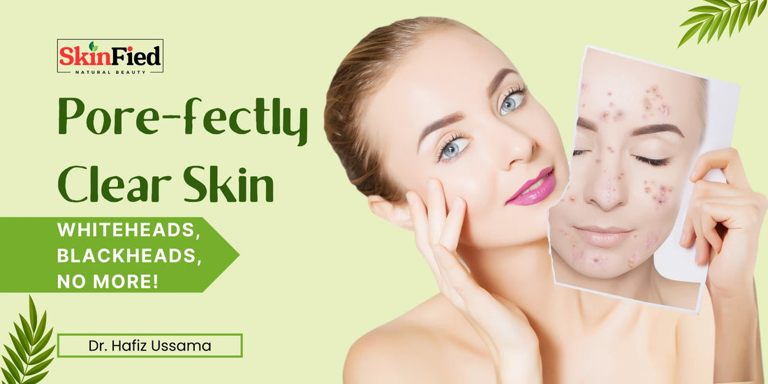 Pore-fectly Clear Skin: Whiteheads, Blackheads, No More!
