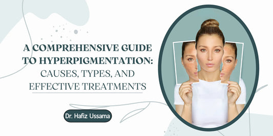 A Comprehensive Guide to Hyperpigmentation or Dark Spots: Causes, Types, and Effective Treatments