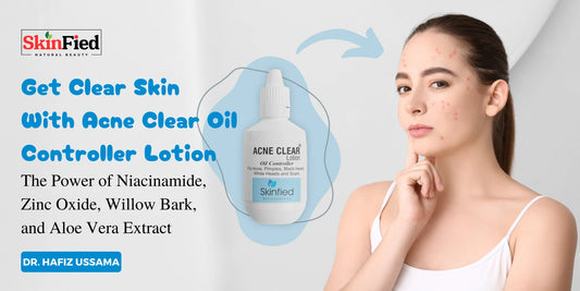 Get Clear Skin with Acne Clear Oil Controller Lotion: The Power of Niacinamide, Zinc Oxide, Willow Bark, and Aloe Vera Extract