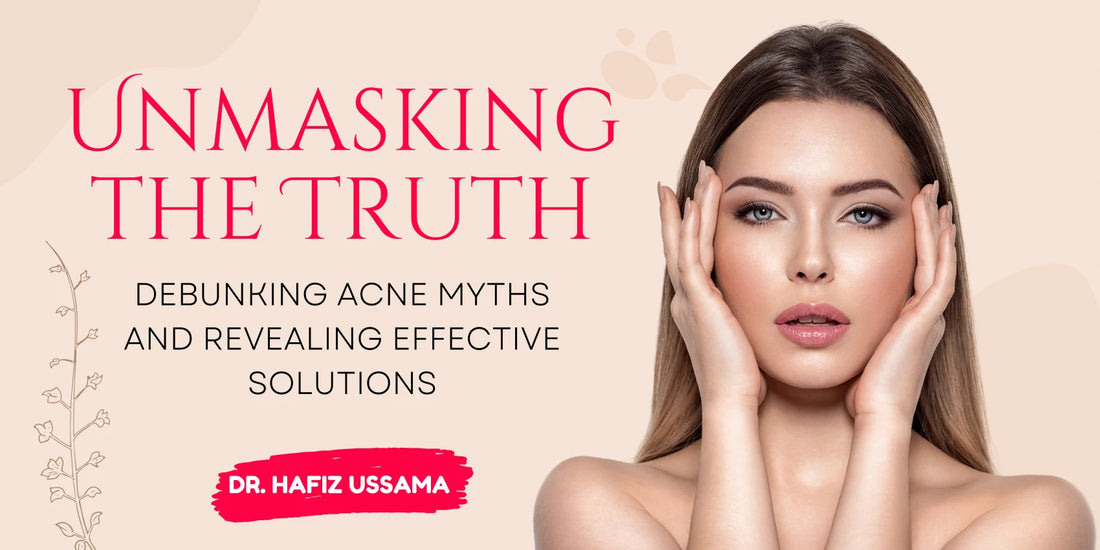 Unmasking the Truth: Debunking Acne Myths and Revealing Effective Solutions